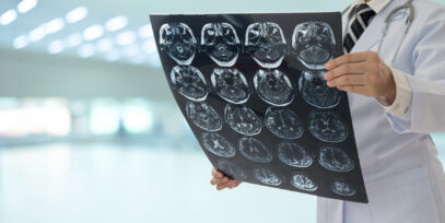 Physician Looking at Brain Scan (1)